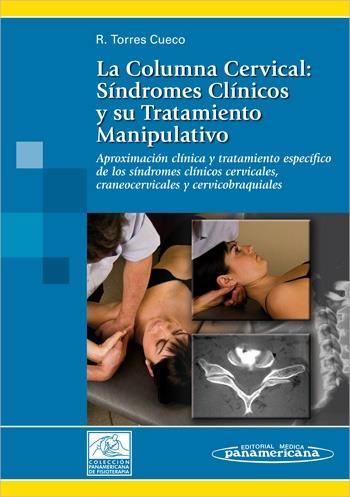 LA COLUMNA CERVICAL:SÍNDROMES CLÍNICOS Y SU TRATAMIENTO MANIPULATIVO | 9788479037086 | TORRES CUECO, RAFAEL | Llibreria Ombra | Llibreria online de Rubí, Barcelona | Comprar llibres en català i castellà online