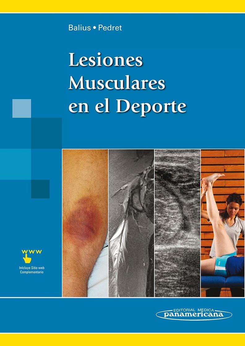 LESIONES MUSCULARES EN EL DEPORTE | 9788498357035 | BALIUS MATAS, RAMÓN | Llibreria Ombra | Llibreria online de Rubí, Barcelona | Comprar llibres en català i castellà online